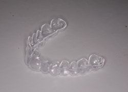 ホワイトニング効果を高めるために歯面のクリーニングを行います。
